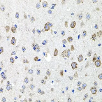 IHC-P analysis of mouse brain tissue using GTX53952 CDH23 antibody. Dilution : 1:100