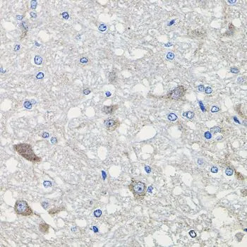 IHC-P analysis of rat brain tissue using GTX53952 CDH23 antibody. Dilution : 1:100