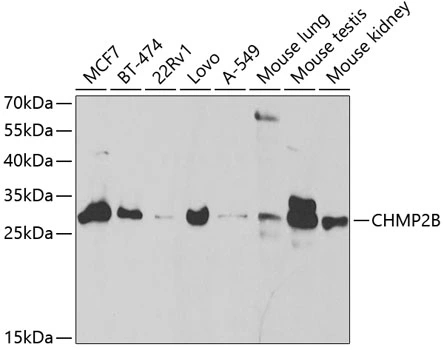 WB analysis of various sample lysates using GTX53958 CHMP2B antibody. Dilution : 1:1000 Loading : 25microg per lane