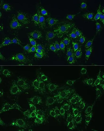 ICC/IF analysis of C6 cells using GTX53959 Cytochrome b5 antibody. Blue : DAPI Dilution : 1:100