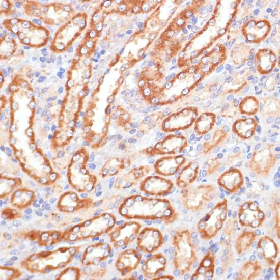 IHC-P analysis of rat kidney tissue using GTX53959 Cytochrome b5 antibody. Dilution : 1:100