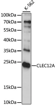 WB analysis of K562 cell lysate using GTX53970 CLEC12A antibody. Dilution : 1:1000 Loading : 25microg per lane WB analysis of K562 cell lysate using GTX53970 CLEC12A antibody. Dilution : 1:1000 Loading : 25microg per lane