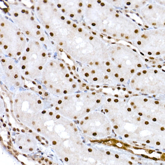 IHC-P analysis of rat kidney tissue using GTX53975 CREB (phospho Ser133) antibody. Antigen retrieval : High pressure antigen retrieval with 10 mM citrate buffer (pH 6) Dilution : 1:200