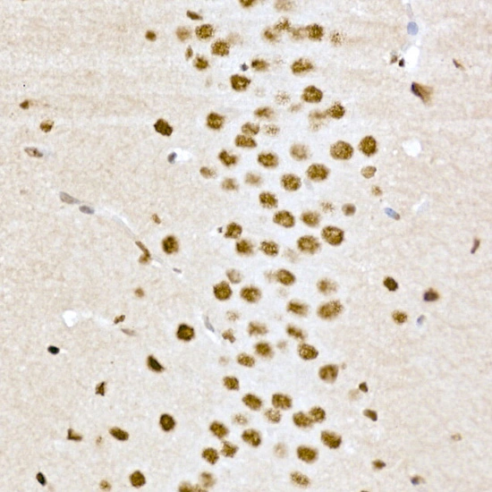 IHC-P analysis of mouse brain tissue using GTX53975 CREB (phospho Ser133) antibody. Antigen retrieval : High pressure antigen retrieval with 10 mM citrate buffer (pH 6) Dilution : 1:200