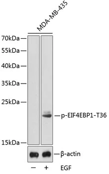 WB analysis of MDA-MB-435 cell lysate using GTX53981 4E-BP1 (phospho Thr36) antibody. Loading : 25microg per lane WB analysis of MDA-MB-435 cell lysate using GTX53981 4E-BP1 (phospho Thr36) antibody. Loading : 25microg per lane
