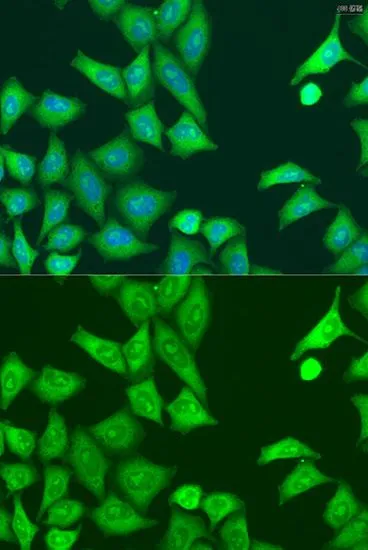 ICC/IF analysis of U2OS cells using GTX53983 PKR antibody. Blue : DAPI Dilution : 1:100