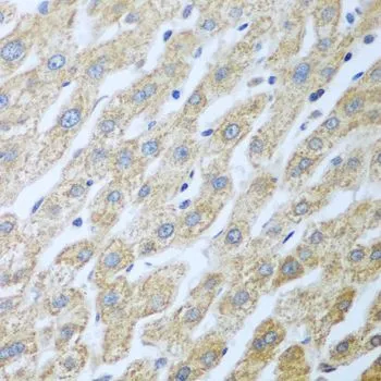 IHC-P analysis of human liver tissue using GTX53983 PKR antibody. Dilution : 1:100