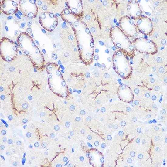 IHC-P analysis of mouse kidney tissue using GTX53995 CD64 antibody. Dilution : 1:100