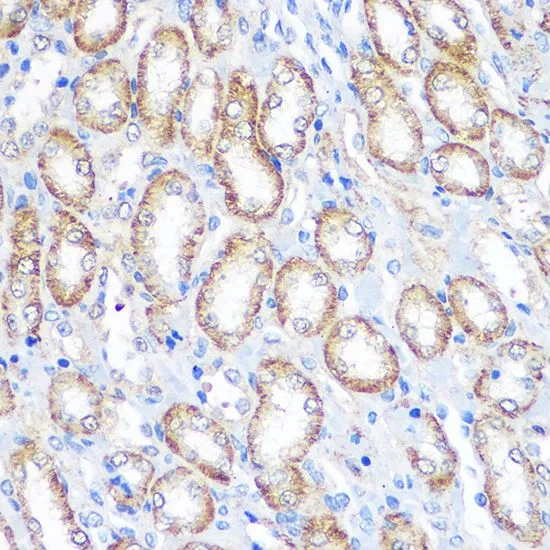 IHC-P analysis of rat kidney tissue using GTX53995 CD64 antibody. Dilution : 1:100