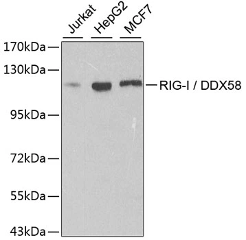 WB analysis of various sample lysates using GTX54000 DDX58 antibody. Dilution : 1:500 Loading : 25microg per lane WB analysis of various sample lysates using GTX54000 DDX58 antibody. Dilution : 1:500 Loading : 25microg per lane