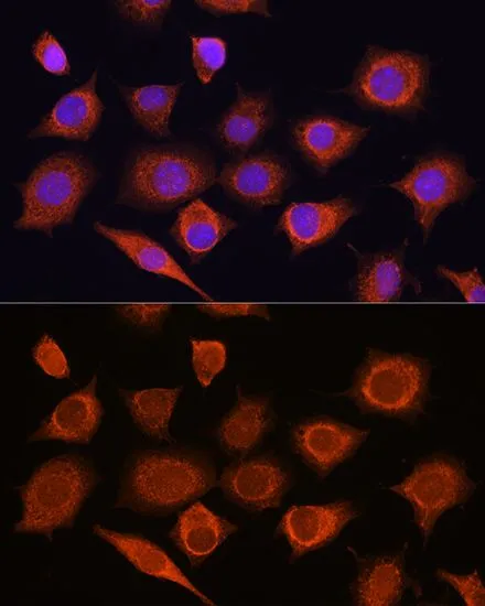 ICC/IF analysis of L929 cells using GTX54000 DDX58 antibody. Blue : DAPI Dilution : 1:100