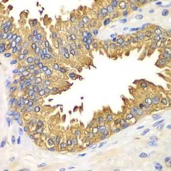 IHC-P analysis of human prostate tissue using GTX54000 DDX58 antibody. Dilution : 1:100