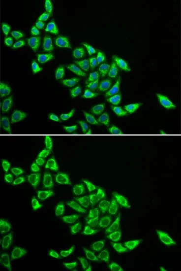 ICC/IF analysis of HeLa cells using GTX54002 DLAT antibody. Blue : DAPI