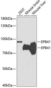 WB analysis of various sample lysates using GTX54005 EPB41 antibody. Dilution : 1:1000 Loading : 25microg per lane WB analysis of various sample lysates using GTX54005 EPB41 antibody. Dilution : 1:1000 Loading : 25microg per lane