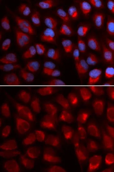 ICC/IF analysis of U2OS cells using GTX54005 EPB41 antibody. Blue : DAPI