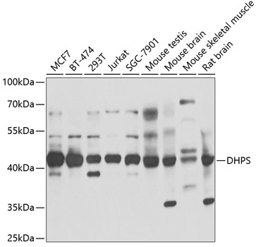 WB analysis of various samples using GTX54011 DHPS antibody.The signal was developed with ECL plus-Enhanced. Dilution : 1:1000 Loading : 25ug per lane