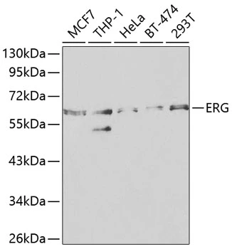 WB analysis of various sample lysates using GTX54015 ERG antibody. Dilution : 1:1000 Loading : 25microg per lane