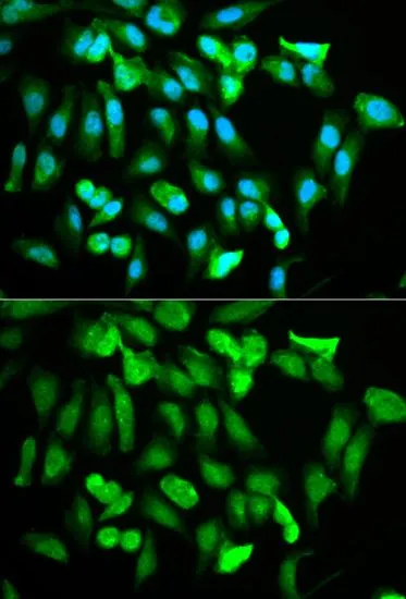 ICC/IF analysis of HeLa cells using GTX54015 ERG antibody. Blue : DAPI