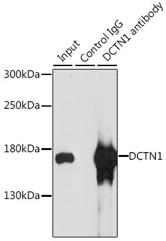 IP analysis of MCF-7 cell lysate using GTX54021 DCTN1 antibody. Antibody amount : 3microg / 200microg lysate Dilution : 1:1000 IP analysis of MCF-7 cell lysate using GTX54021 DCTN1 antibody. Antibody amount : 3microg / 200microg lysate Dilution : 1:1000