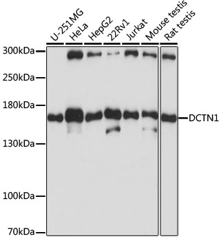 WB analysis of various sample lysates using GTX54021 DCTN1 antibody. Dilution : 1:1000 Loading : 25microg per lane
