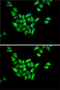 ICC/IF analysis of HeLa cells using GTX54021 DCTN1 antibody. Blue : DAPI