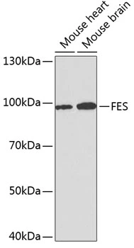 WB analysis of various sample lysates using GTX54025 FES antibody. Dilution : 1:1000 Loading : 25microg per lane WB analysis of various sample lysates using GTX54025 FES antibody. Dilution : 1:1000 Loading : 25microg per lane