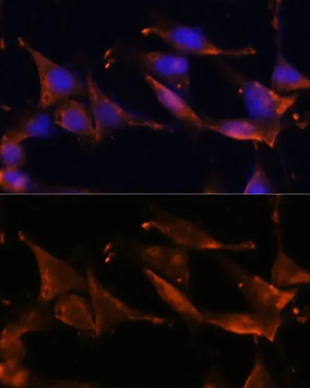 ICC/IF analysis of NIH/3T3 cells using GTX54026 Fibrinogen gamma antibody. Blue : DAPI Dilution : 1:100
