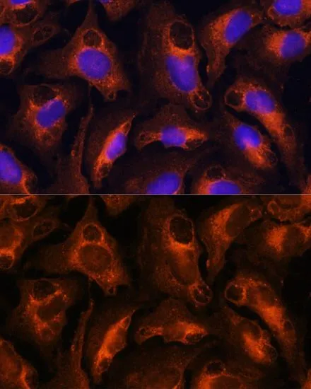 ICC/IF analysis of U2OS cells using GTX54026 Fibrinogen gamma antibody. Blue : DAPI Dilution : 1:100