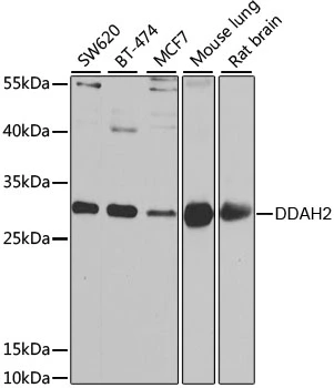 WB analysis of various sample lysates using GTX54028 DDAH2 antibody. Dilution : 1:1000 Loading : 25microg per lane WB analysis of various sample lysates using GTX54028 DDAH2 antibody. Dilution : 1:1000 Loading : 25microg per lane