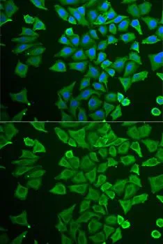 ICC/IF analysis of U2OS cells using GTX54028 DDAH2 antibody. Blue : DAPI