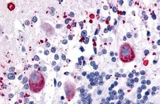 IHC-P analysis of human brain, cerebellum tissue using GTX54050 5-HT7 receptor antibody. Antigen retrieval : Heat-induced antigen retrieval IHC-P analysis of human brain, cerebellum tissue using GTX54050 5-HT7 receptor antibody. Antigen retrieval : Heat-induced antigen retrieval