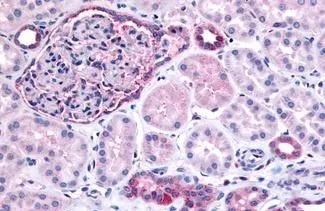 IHC-P analysis of human glomerulus and renal tubular epithelium in cortex tissue using GTX54063 PIB5PA antibody. Antigen retrieval : Heat-induced antigen retrieval IHC-P analysis of human glomerulus and renal tubular epithelium in cortex tissue using GTX54063 PIB5PA antibody. Antigen retrieval : Heat-induced antigen retrieval