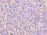 IHC analysis of human spleen tissue using GTX54076 IL27 Receptor alpha antibody.
