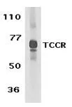 WB analysis of human spleen tissue lysate using GTX54076 IL27 Receptor alpha antibody. WB analysis of human spleen tissue lysate using GTX54076 IL27 Receptor alpha antibody.