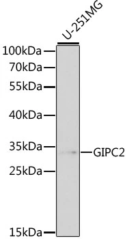 WB analysis of various sample lysates using GTX54083 GIPC2 antibody. Dilution : 1:1000 Loading : 25microg per lane WB analysis of various sample lysates using GTX54083 GIPC2 antibody. Dilution : 1:1000 Loading : 25microg per lane