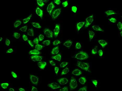 ICC/IF analysis of A549 cells using GTX54092 HSD3B2 antibody.