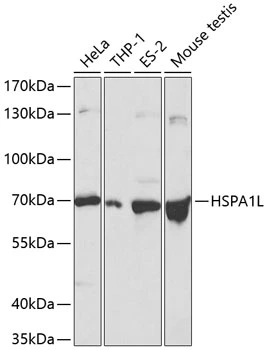 WB analysis of various sample lysates using GTX54093 HSP70 1L antibody. Dilution : 1:500 Loading : 25microg per lane
