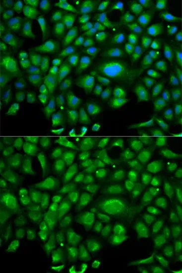 ICC/IF analysis of U2OS cells using GTX54093 HSP70 1L antibody. Blue : DAPI