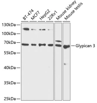 WB analysis of various sample lysates using GTX54096 Glypican-3 antibody. Dilution : 1:1000 Loading : 25microg per lane WB analysis of various sample lysates using GTX54096 Glypican-3 antibody. Dilution : 1:1000 Loading : 25microg per lane