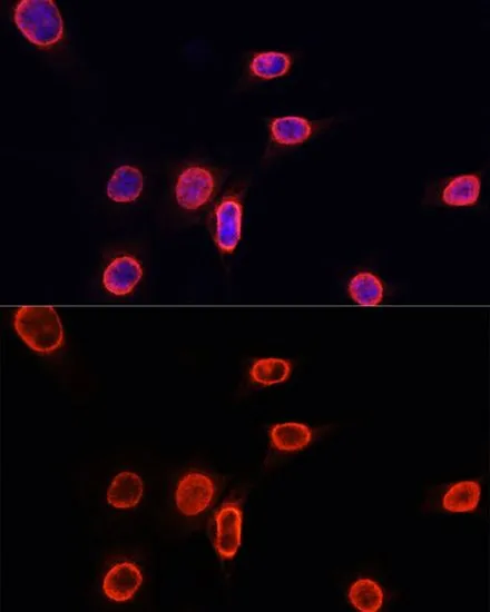 ICC/IF analysis of NIH/3T3 cells using GTX54101 Histone H3K9me1 (mono-methyl Lys9) antibody. Blue : DAPI Dilution : 1:100