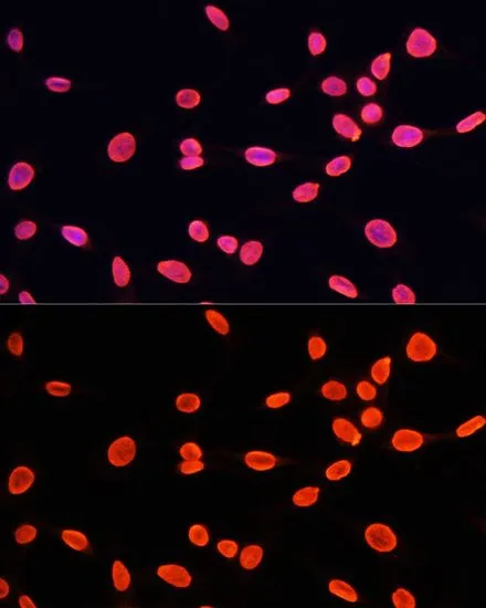 ICC/IF analysis of C6 cells using GTX54101 Histone H3K9me1 (mono-methyl Lys9) antibody. Blue : DAPI Dilution : 1:100