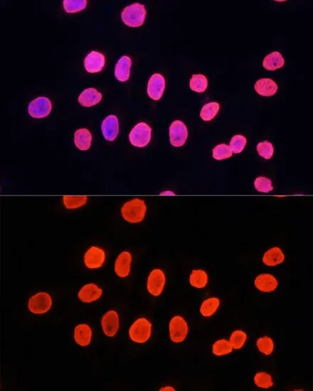 ICC/IF analysis of HeLa cells using GTX54101 Histone H3K9me1 (mono-methyl Lys9) antibody. Blue : DAPI Dilution : 1:100