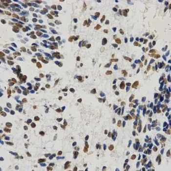 IHC-P analysis of human embryo brain tissue using GTX54101 Histone H3K9me1 (mono-methyl Lys9) antibody. Dilution : 1:200