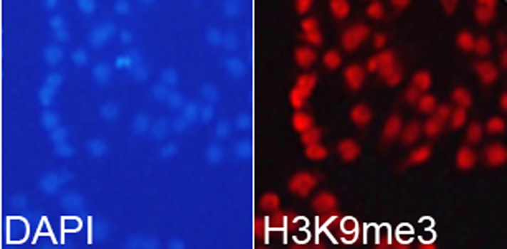 IHC-P analysis of mouse brain tissue using GTX54103 Histone H3K9me3 (tri-methyl Lys9) antibody. Dilution : 1:100