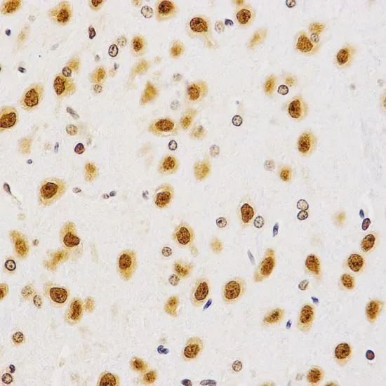 IHC-P analysis of rat brain tissue using GTX54116 Histone H4R3me2 (di-methyl Arg3) antibody. Dilution : 1:200