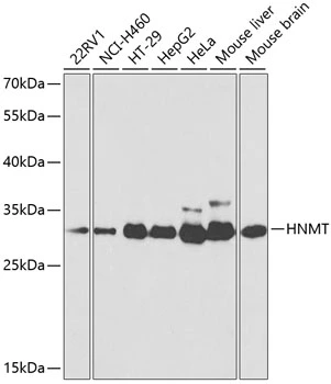 WB analysis of various sample lysates using GTX54118 HNMT antibody. Dilution : 1:1000 Loading : 25microg per lane