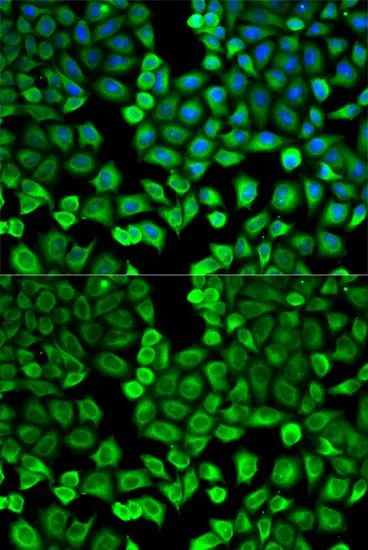 ICC/IF analysis of U2OS cells using GTX54118 HNMT antibody. Blue : DAPI