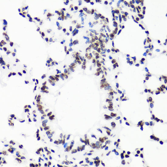 WB analysis of various samples using GTX54131 Histone H3R17me1 (mono-methyl Arg17) antibody. Loading : 25ug per lane