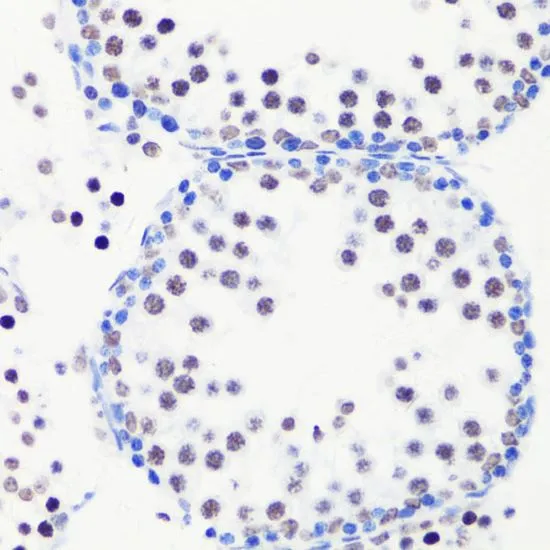 IHC-P analysis of mouse testis tissue using GTX54135 Histone H3R8me1 (mono-methyl Arg8) antibody. Dilution : 1:100