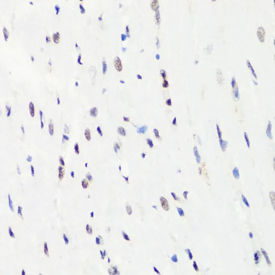 IHC-P analysis of rat heart tissue using GTX54135 Histone H3R8me1 (mono-methyl Arg8) antibody. Dilution : 1:100